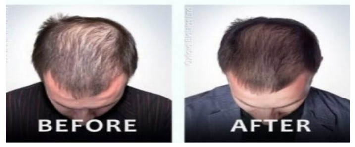 New Jersey hair loss treatment center