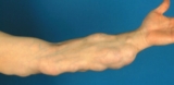 Let’s Find the Best Plastic Surgery in Costa Mesa, CA